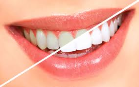 whitening image